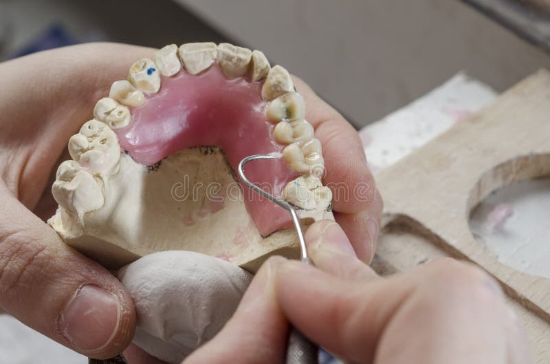 Tand- tekniker som gör partiska tandproteser av akrylkådor