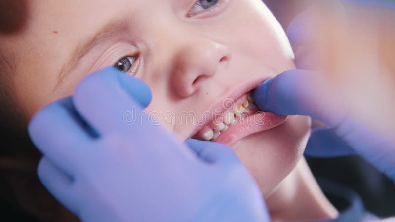 Tandheelkunde Sluit omhoog stock video.