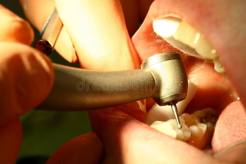 Que hacer cuando la anestesia dental no hace efecto