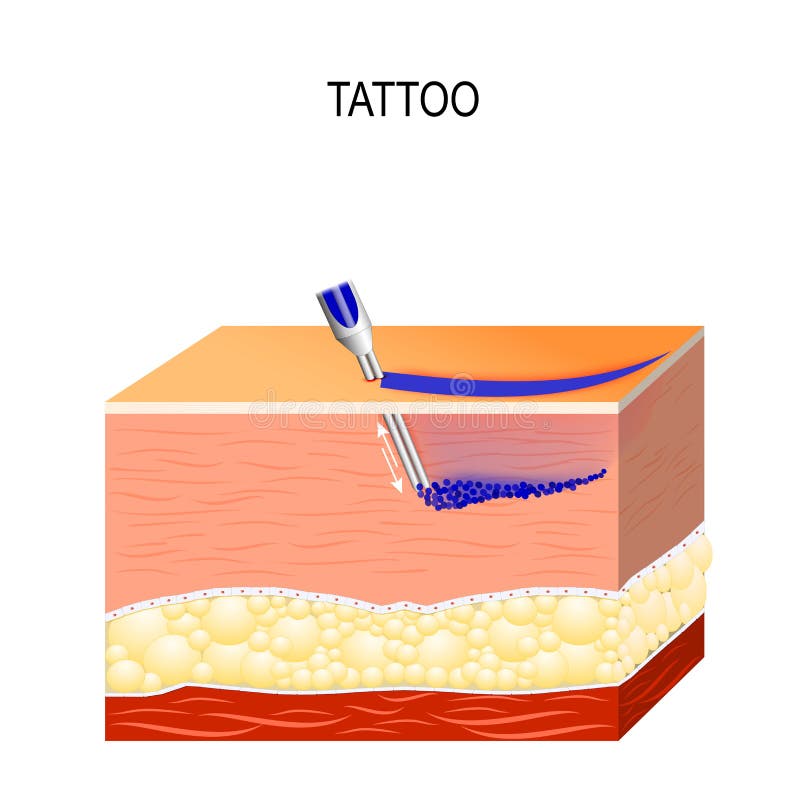 Tattoo Process. the Tattooing Process Causes Damage To the Epidermis
