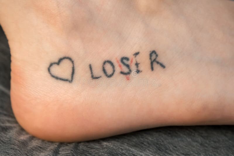 Laser Removing of Tattoo with Words Loser, Lover and Heart on Woman& X27;s Foot. Stock Photo - Image of paint, artistic: 236423274 Laser Removing of Tattoo with Words Loser, Lover and Heart on Woman& X27;s Foot. Stock Photo - Image of paint, artistic: 236423274