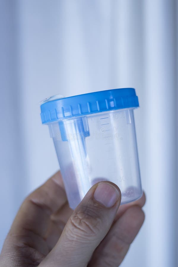 Campione Di Urina Con Le Strisce Test Ed Il Rene Immagine Stock - Foto 7