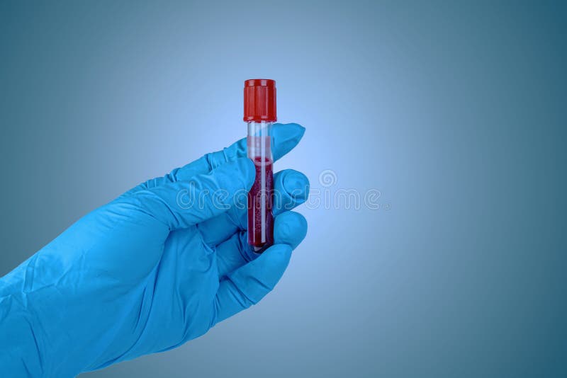 Technician Holding Blood Tube Test in the Research Laboratory Stock Image Image of chemistry