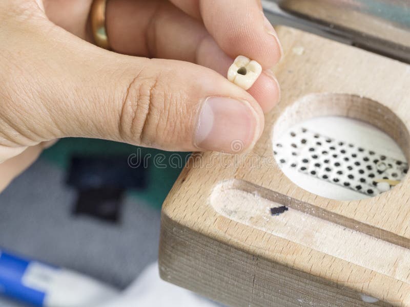 Technicien dentaire présent une dent, un implant dentaire dans une bosselure image stock Technicien dentaire présent une dent, un implant dentaire dans une bosselure image stock