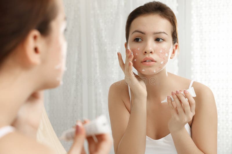 Teen girl with acne problem applying cream near mirror