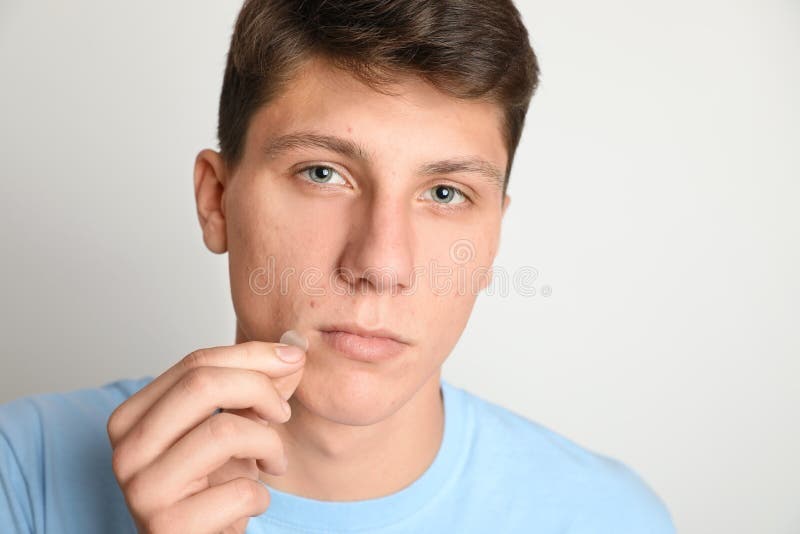 Teen guy applying acne healing patch on background