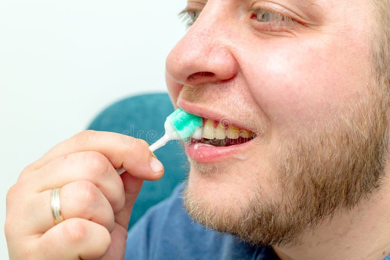 Teeth whitening procedure stock photo. Image of care 144784686