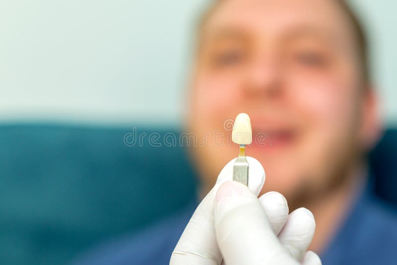 Teeth whitening procedure stock image. Image of dentistry 144784951