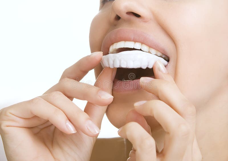 Beautiful smiling girl with tooth tray (hands holding individual tooth tray). Beautiful smiling girl with tooth tray (hands holding individual tooth tray)