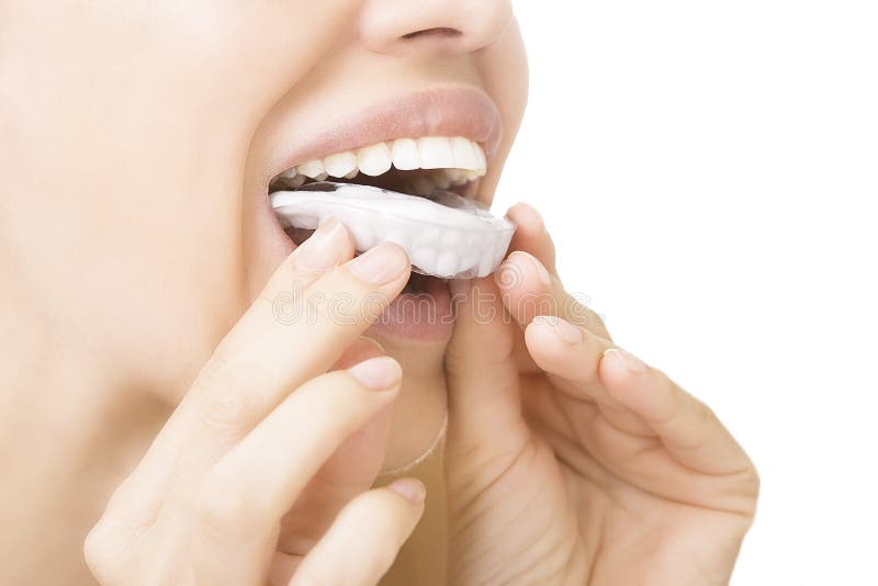 Beautiful smiling girl with tooth tray (hands holding individual tooth tray). Beautiful smiling girl with tooth tray (hands holding individual tooth tray)