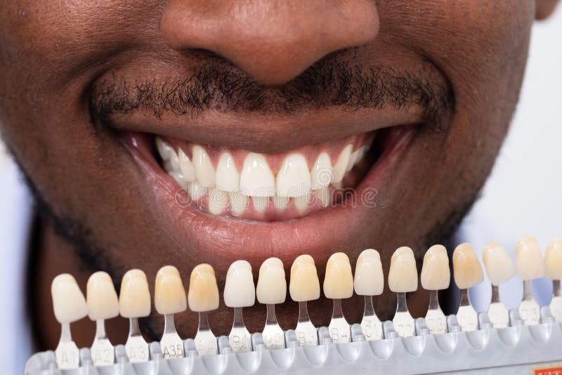 Close-up Of A Smiling African Man Holding Set Of Implants With Various Shades Of Tone. Close-up Of A Smiling African Man Holding Set Of Implants With Various Shades Of Tone