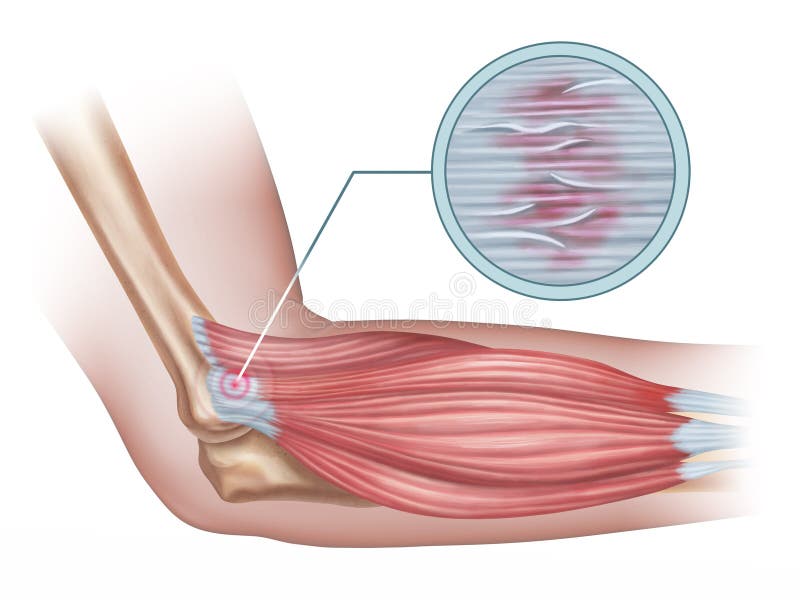 Contracting and relaxing of arms biceps and triceps muscles outline  diagram. Labeled educational scheme with anatomical contracted and relaxed  muscular system structure description vector illustration Stock-vektor