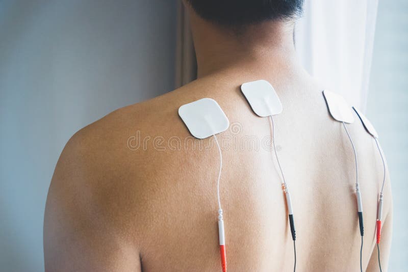 https://thumbs.dreamstime.com/b/tens-treatment-physical-therapy-young-man-tens-his-b-tens-treatment-physical-therapy-young-man-tens-his-back-124785945.jpg