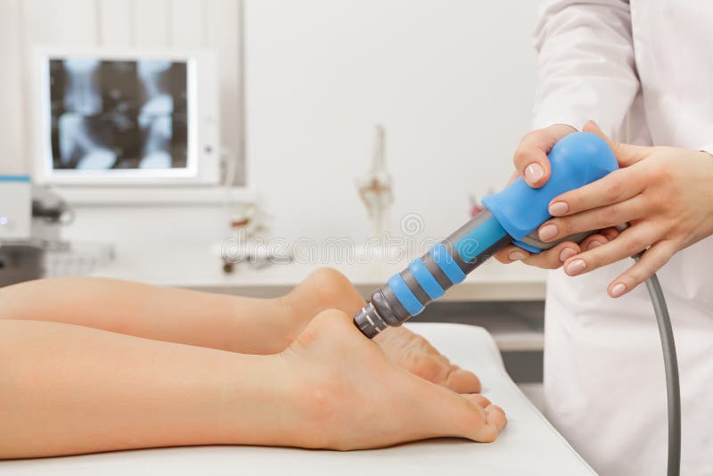 Extracorporeal Shockwave Therapy ESWT.Effective non-surgical treatment.Physical therapy for plantarfascitis with shock waves.Pain relief, normalization and regeneration,stimulation of healing process. Extracorporeal Shockwave Therapy ESWT.Effective non-surgical treatment.Physical therapy for plantarfascitis with shock waves.Pain relief, normalization and regeneration,stimulation of healing process.