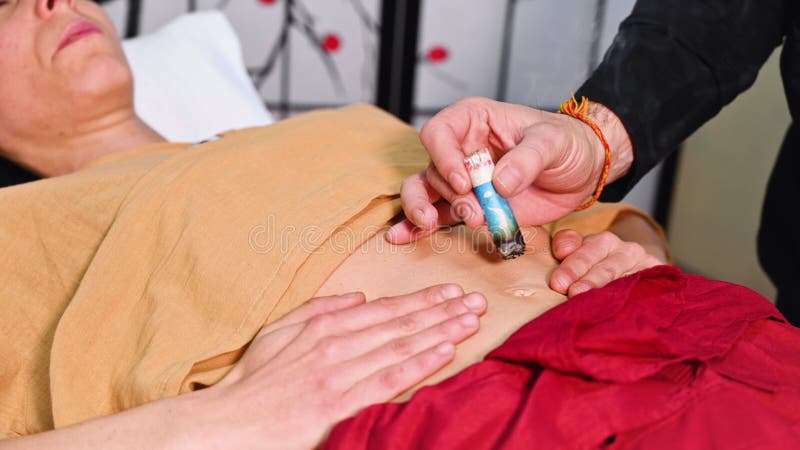 Terapista alternativo che applica moxibustione come metodo di medicina cinese tradizionale.