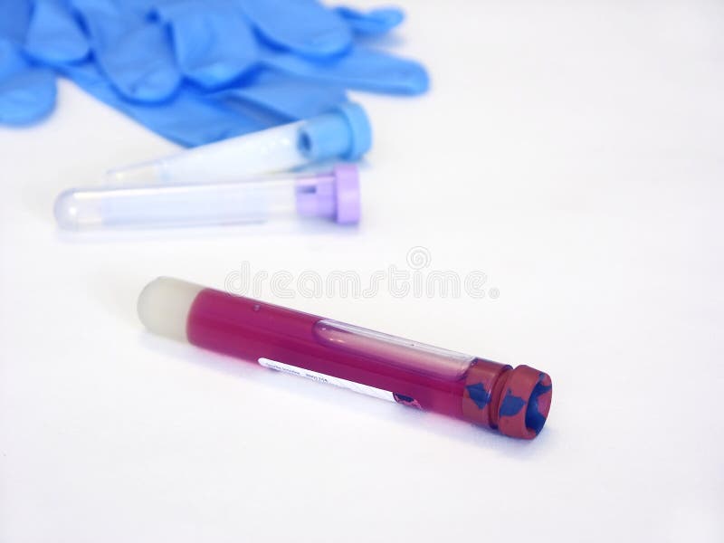 Download Test photo stock. Image du science, glace, gants, examiner - 80246
