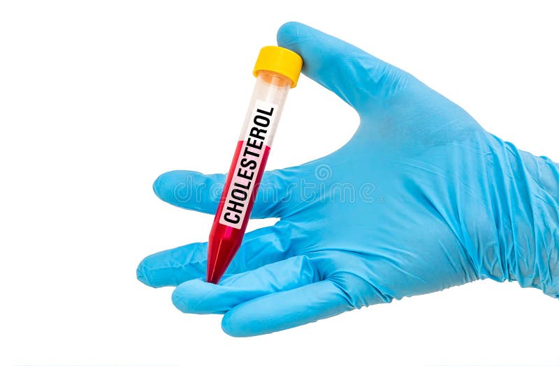 Test-buis met bloedmonster voor CHOLESTEROL stock foto Test-buis met bloedmonster voor CHOLESTEROL stock foto