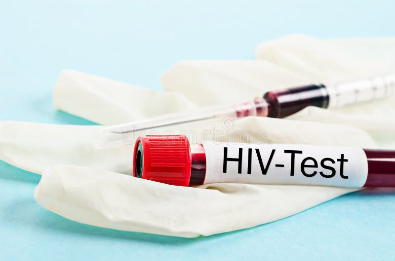 Test de dépistage d'HIV image stock Test de dépistage d'HIV image stock