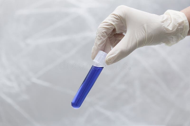 Testtube with Blood Sample in Bio Lab Stock Photo Image of drug