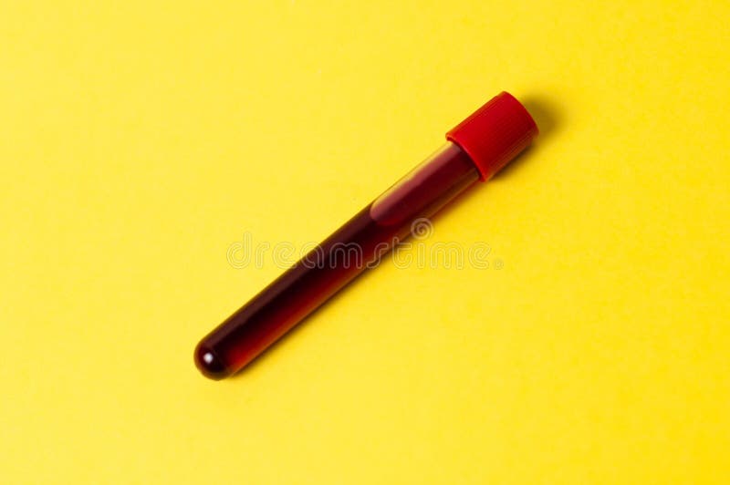 Test Tube with Blood Isolate on a Yellow Background Stock Image Image of chemical, biology
