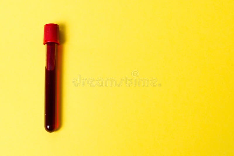 Download 815 Yellow Substance Test Tube Photos Free Royalty Free Stock Photos From Dreamstime Yellowimages Mockups