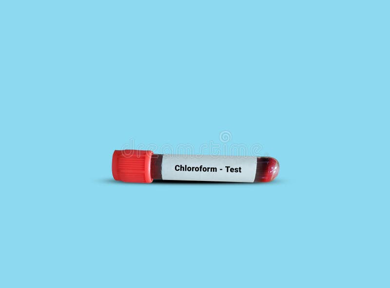 Test Tube With Blood Sample For Chloroform Test Stock Image Image Of Cardiomyopathy Chemicals 215526993