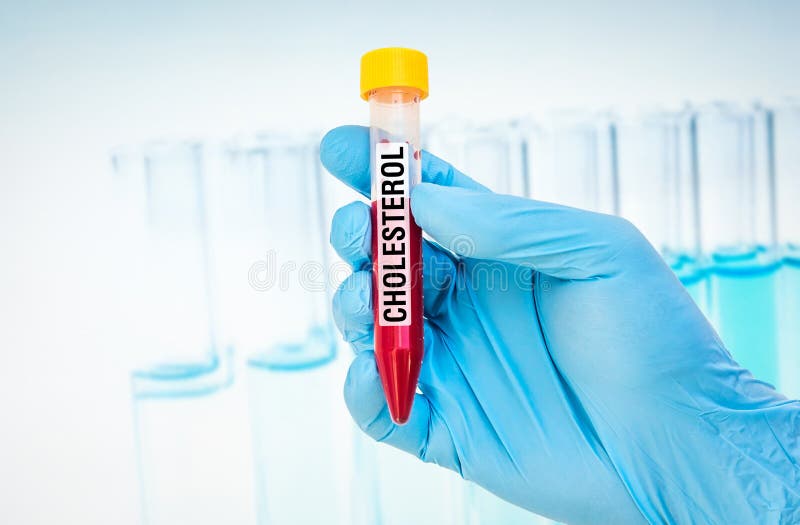 Test-tube with blood sample for CHOLESTEROL test stock photo Test-tube with blood sample for CHOLESTEROL test stock photo