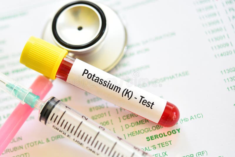 Blood Sample for Potassium Test Stock Image Image of magnesium