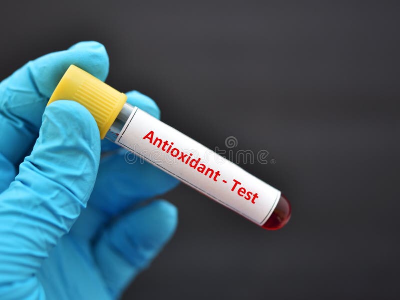 Blood Sample Tube For Procalcitonin Test Stock Photo Image of marker