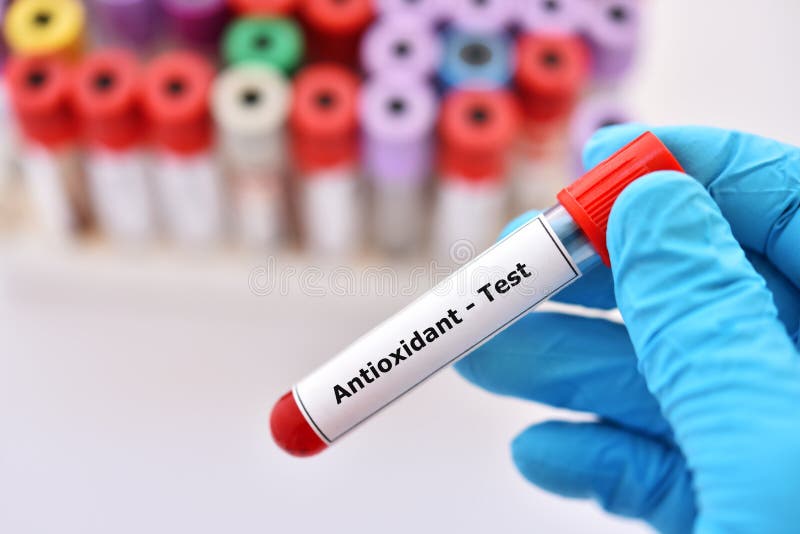 Blood Sample Tube For Procalcitonin Test Stock Photo Image of marker