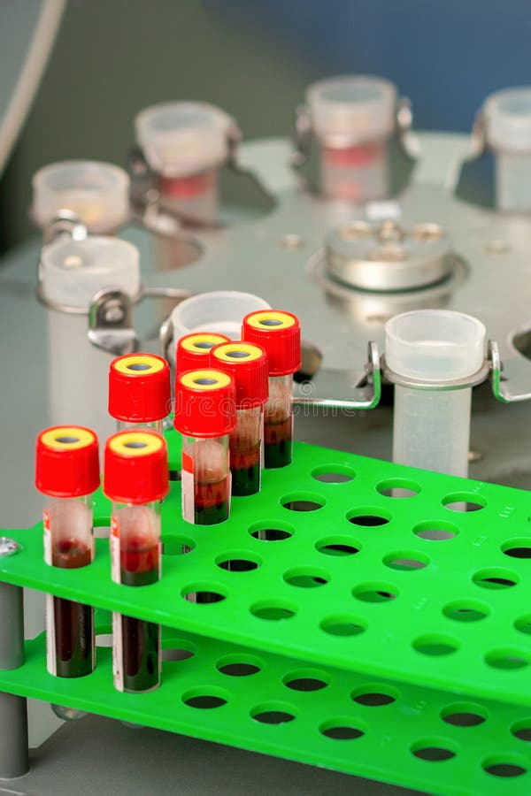Rack Of Centrifuge Vials With Blood Stock Image Image of blood, tubes