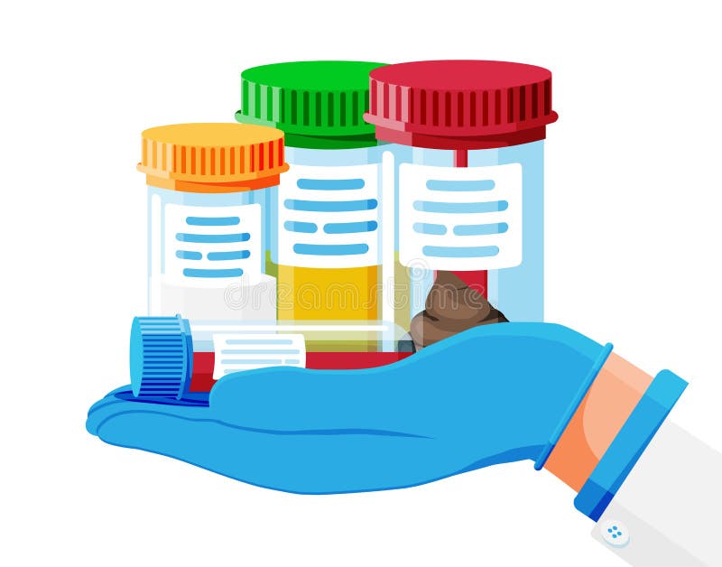 Test Tubes with Caps. Stool, Blood, Urine, Sperm. royalty free illustration