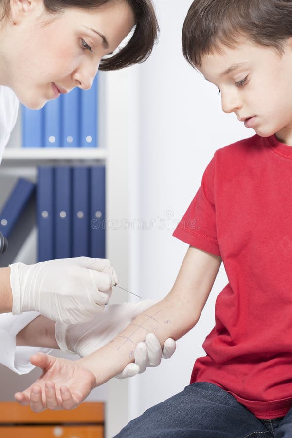 Child having done skin allergy test. Child having done skin allergy test