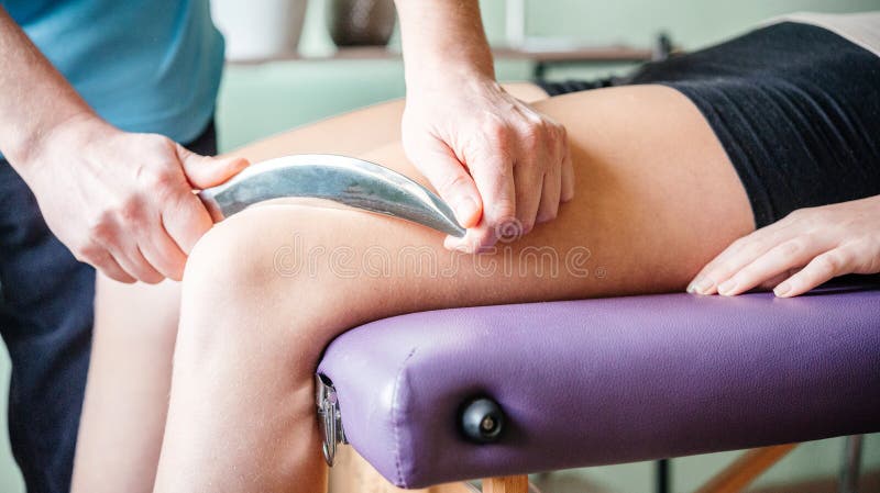 Therapist using IASTM instrument for soft tissue treatment on the leg of a female patient stock image