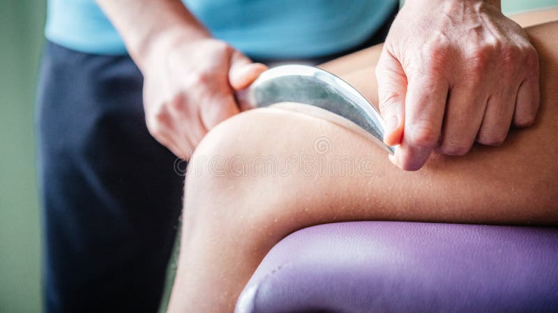 Therapist using IASTM instrument for soft tissue treatment on the leg of a female patient royalty free stock image