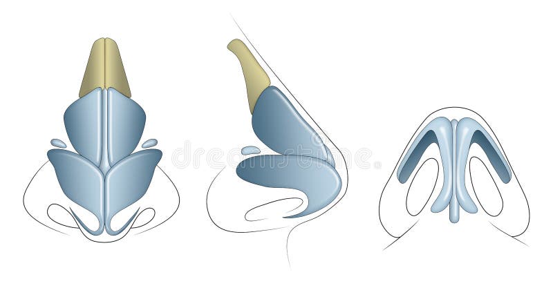 The Nasal Cartilages are the Septal, Lateral, Major Alar, and Minor ...