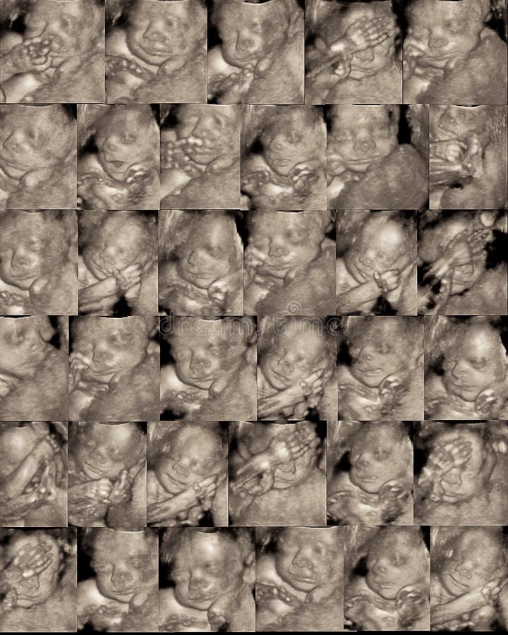 Three dimensional sonogram royalty free stock images