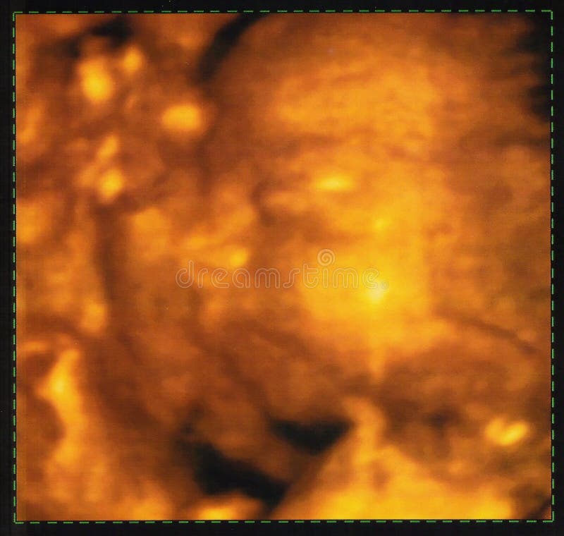 Three-dimensional sonogram stock photography