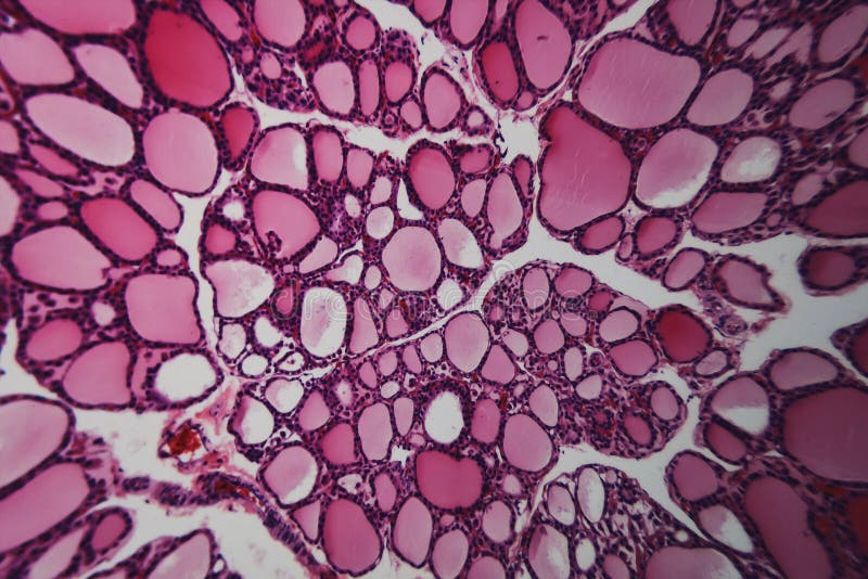 Thyroid gland dogs stock image. Image of medicinal, anatomical 103354505