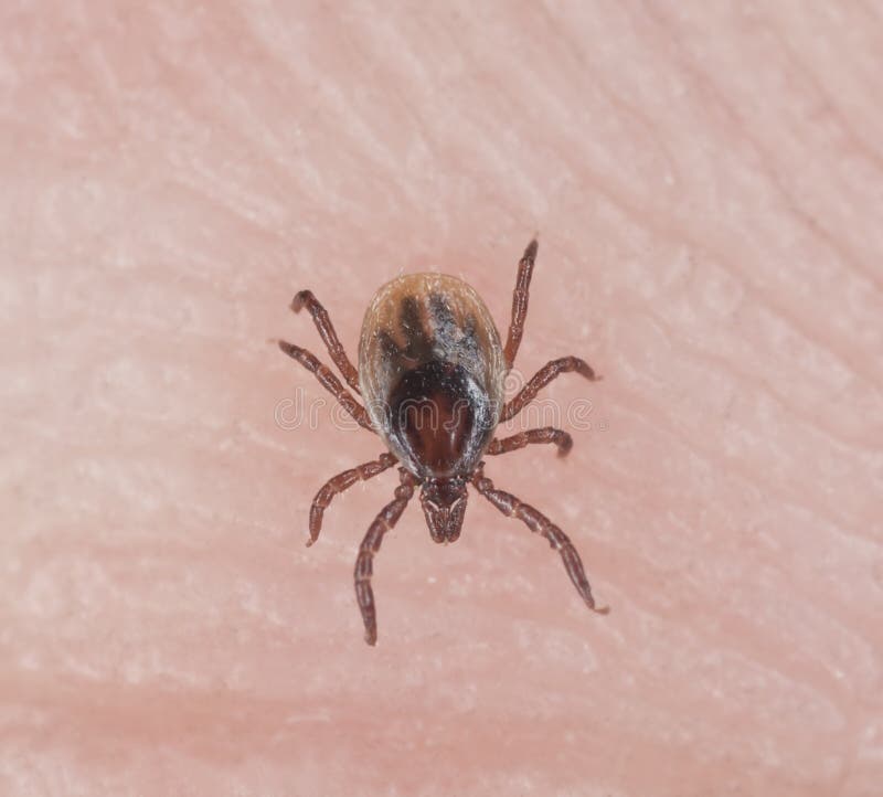 Tick crawling on human skin