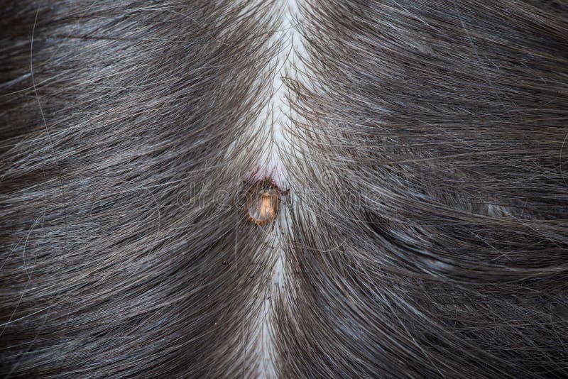 Tick Bite On Head