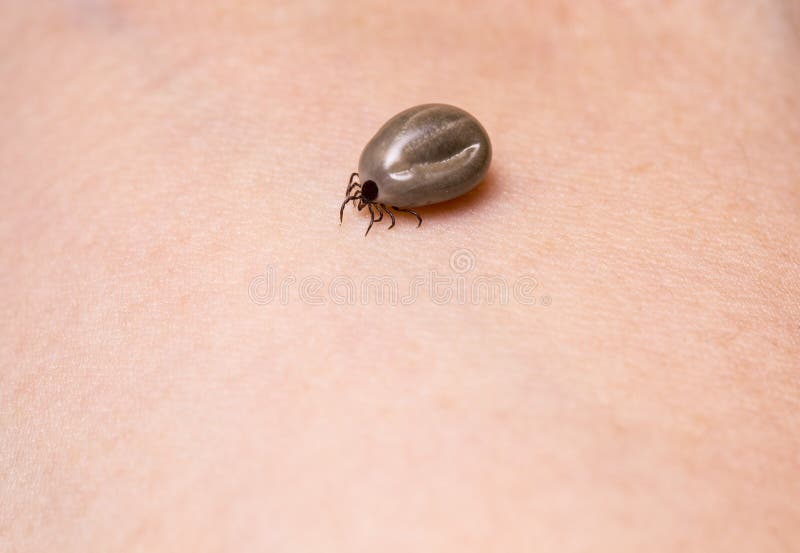 tick in skin tick in skin