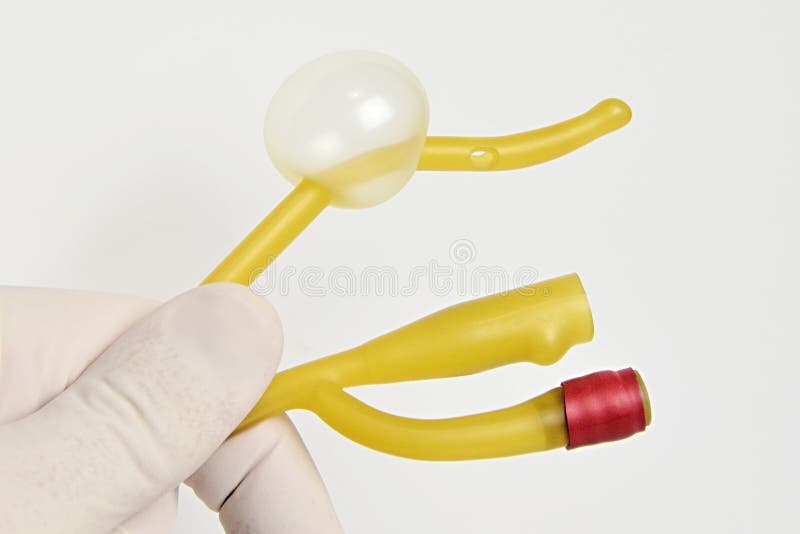 Tiemann技巧乳汁有两流明的泌尿学导尿管在左手举行了 库存图片