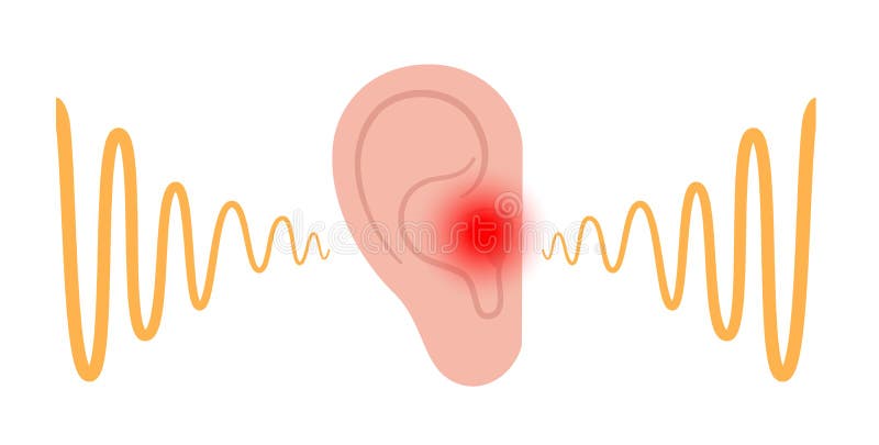 Acupuncture for Tinnitus(Ear Ringing)