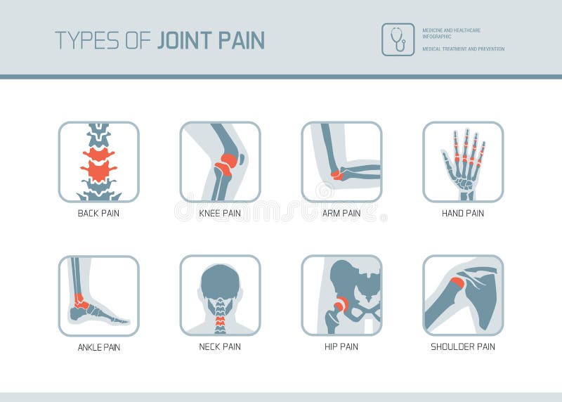 Tipos de dolor común