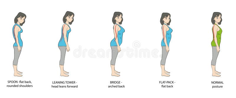 Tipos de mulheres da postura Ilustração do vetor ilustração royalty free Tipos de mulheres da postura Ilustração do vetor ilustração royalty free