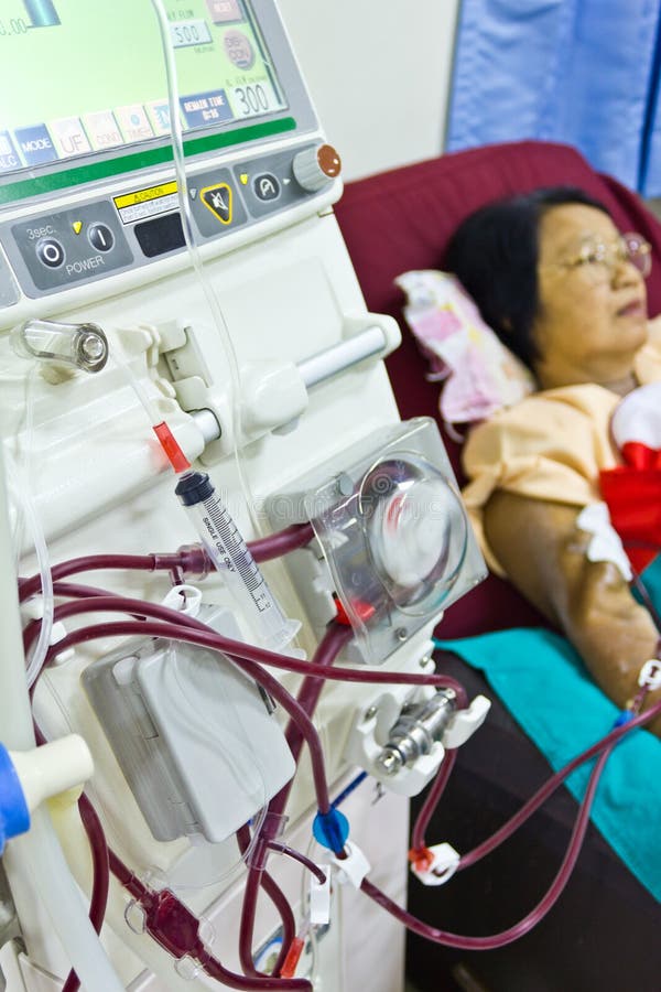 To Purify the Blood with Artificial Kidney Stock Photo Image of donor