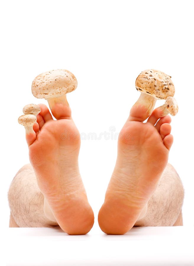 Free Toe Nail And Skin Fungus Royalty Free Stock Photo - 17155055