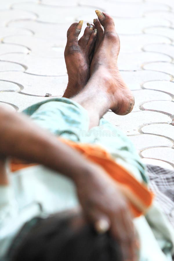 Toe nails stock photo. Image of neglect, long, unhygienic 66467140