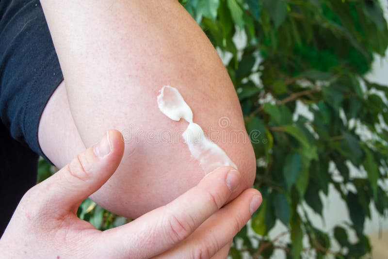 Toepassing van medische zalf op huid op gebied van elleboog De patiënt legt zalf met drugsubstantie door vinger van andere hand o stock foto's Toepassing van medische zalf op huid op gebied van elleboog De patiënt legt zalf met drugsubstantie door vinger van andere hand o stock foto's